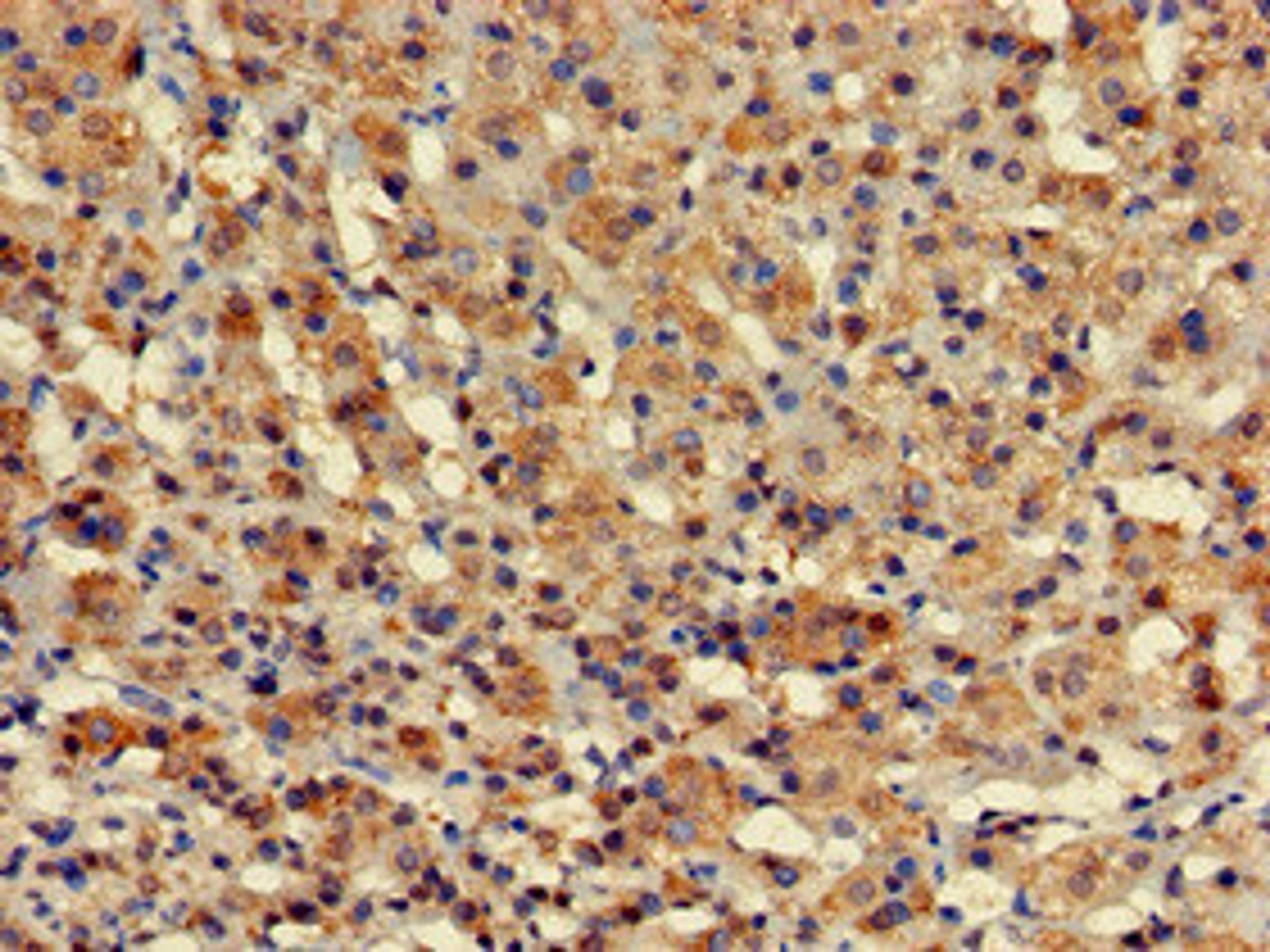 Immunohistochemistry of paraffin-embedded human adrenal gland tissue using CSB-PA21019A0Rb at dilution of 1:100