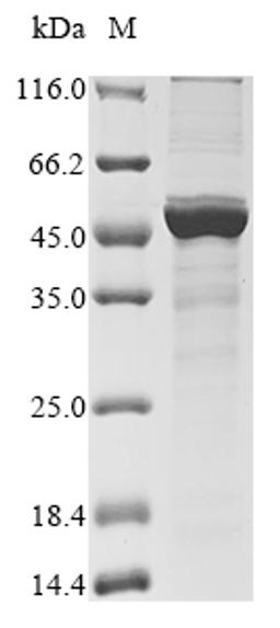 (Tris-Glycine gel) Discontinuous SDS-PAGE (reduced) with 5% enrichment gel and 15% separation gel.