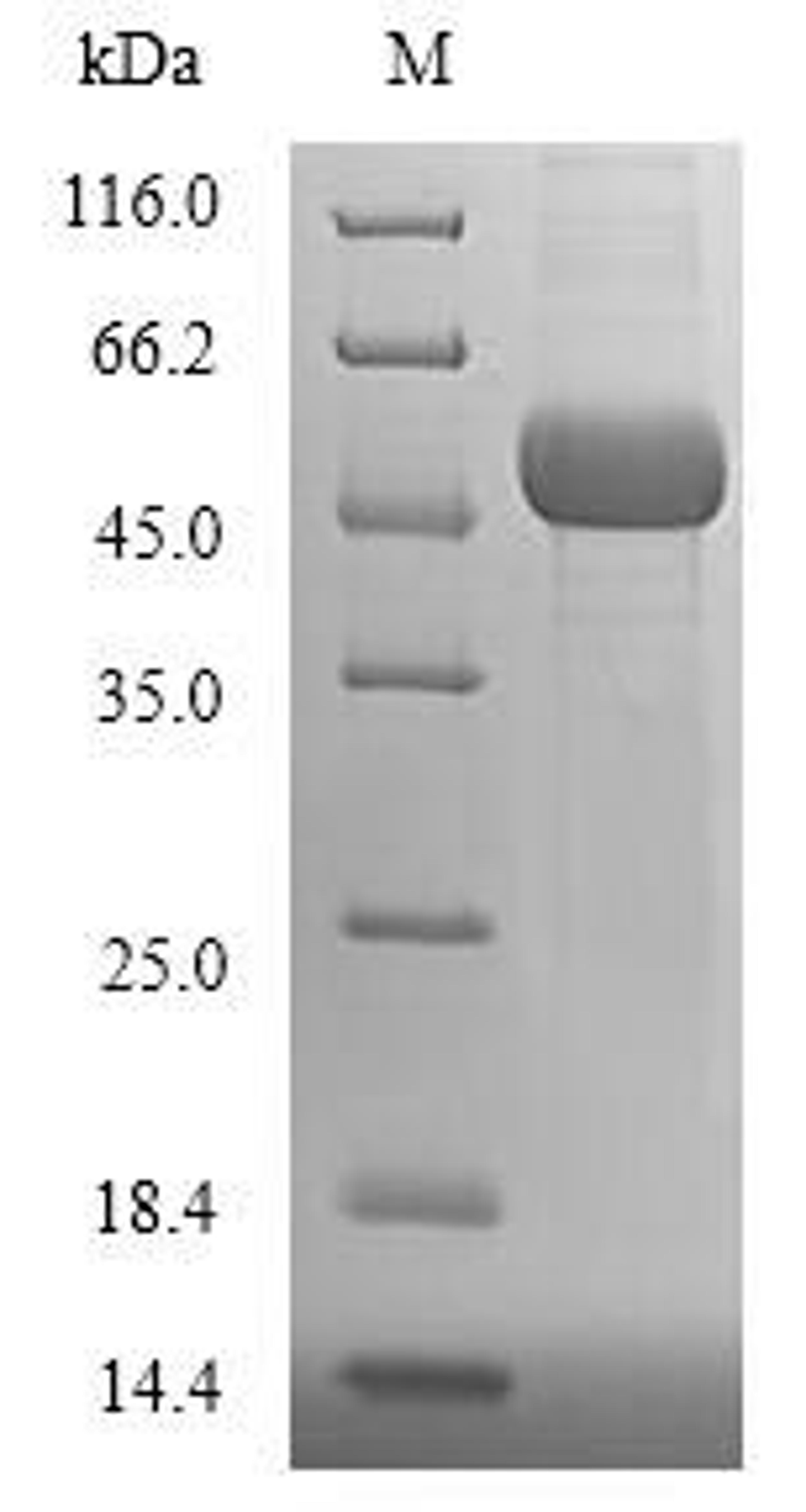 (Tris-Glycine gel) Discontinuous SDS-PAGE (reduced) with 5% enrichment gel and 15% separation gel.