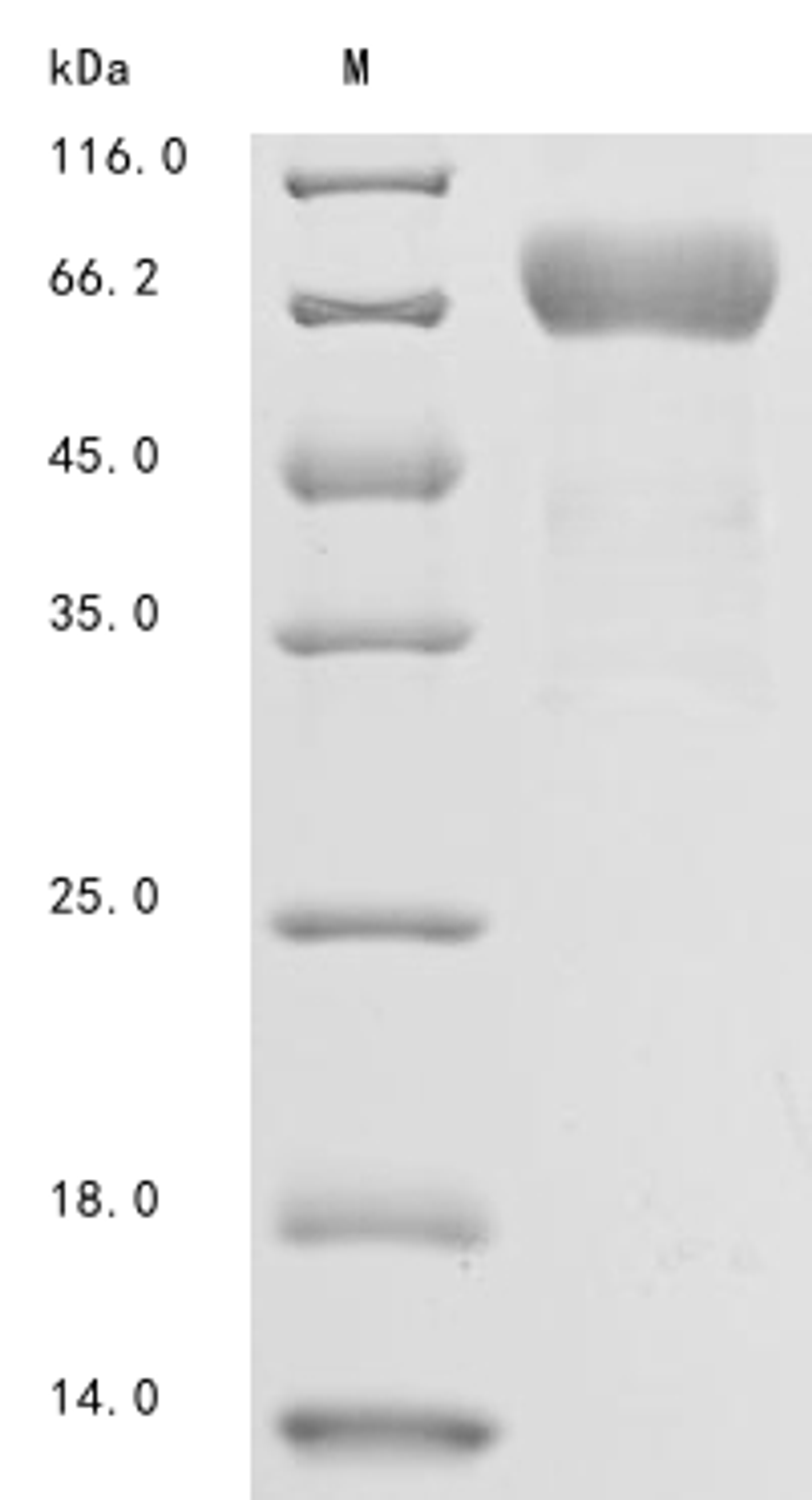 (Tris-Glycine gel) Discontinuous SDS-PAGE (reduced) with 5% enrichment gel and 15% separation gel.