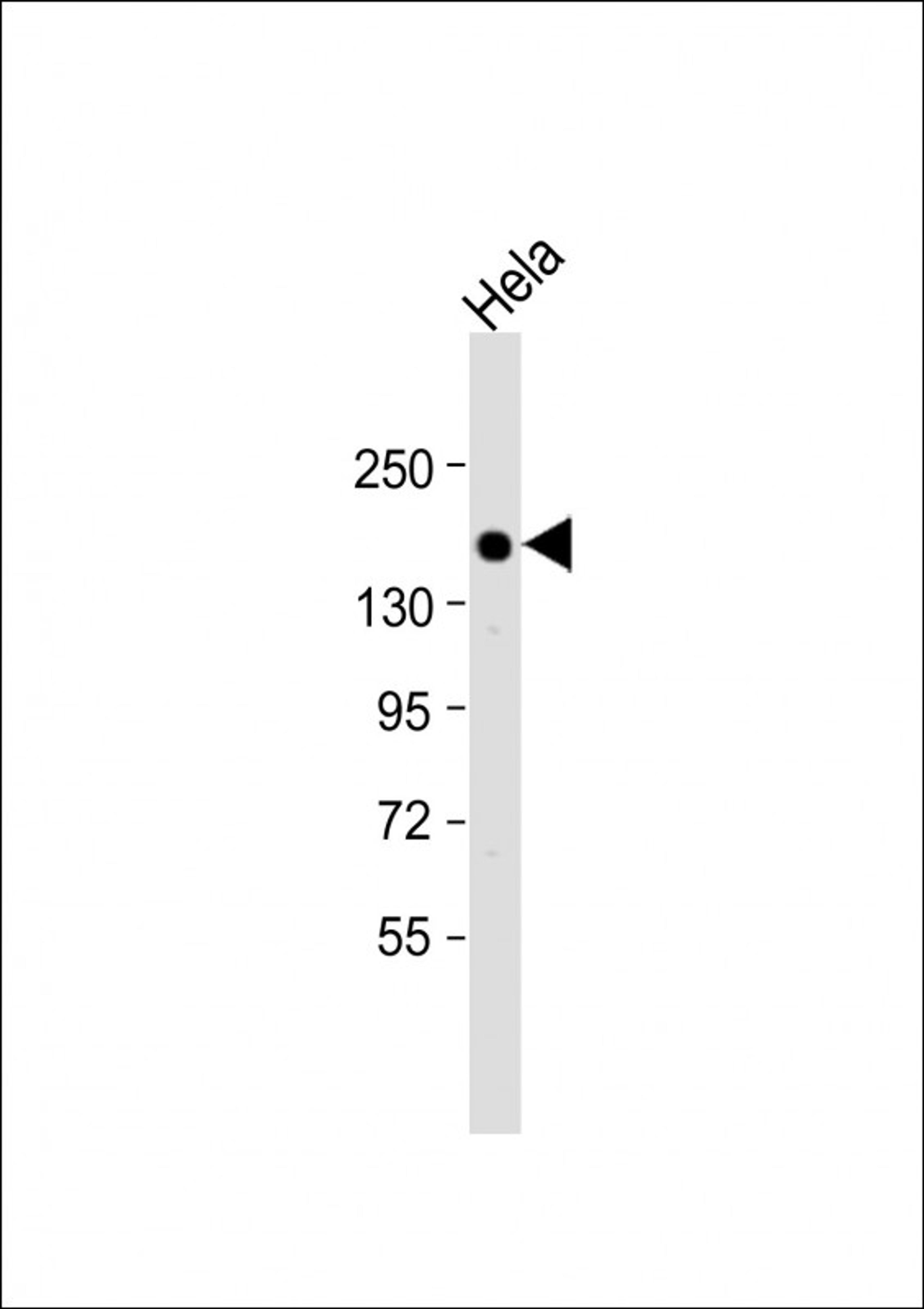 Western Blot at 1:1000 dilution + Hela whole cell lysate Lysates/proteins at 20 ug per lane.