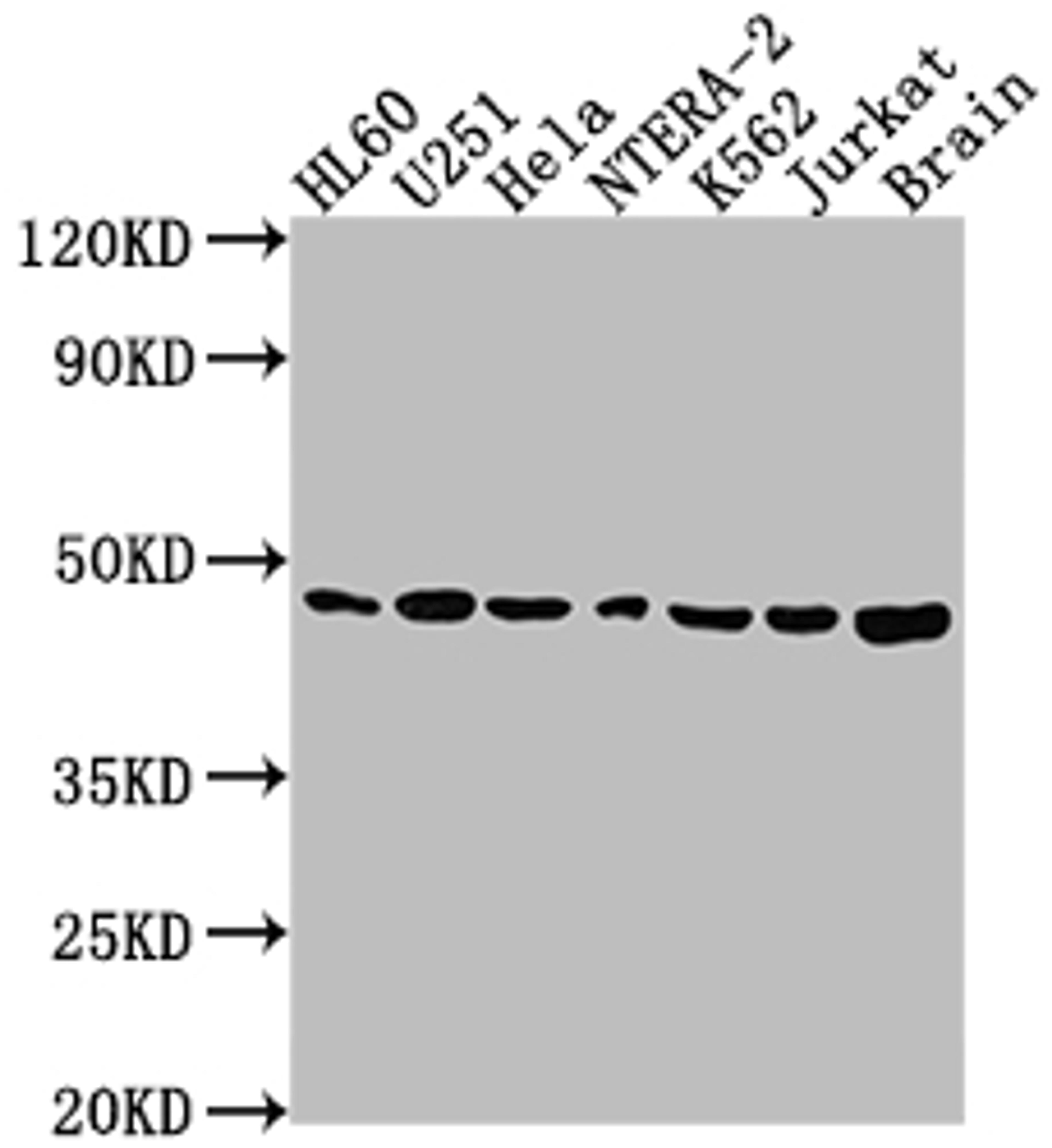 Western Blot. Positive WB detected in: HL60 whole cell lysate, U251 whole cell lysate, Hela whole cell lysate, NTERA-2 whole cell lysate, K562 whole cell lysate, Jurkat whole cell lysate, Rat brain tissue. All lanes: F3 antibody at 1:1500. Secondary. Goat polyclonal to rabbit IgG at 1/50000 dilution. Predicted band size: 34, 28 kDa. Observed band size: 46 kDa. 