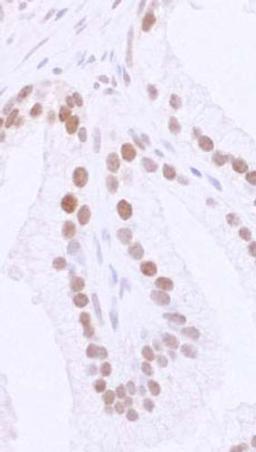 Detection of human 53BP1 by immunohistochemistry.