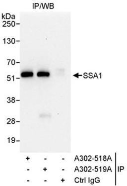 Detection of human SSA1 by western blot of immunoprecipitates.