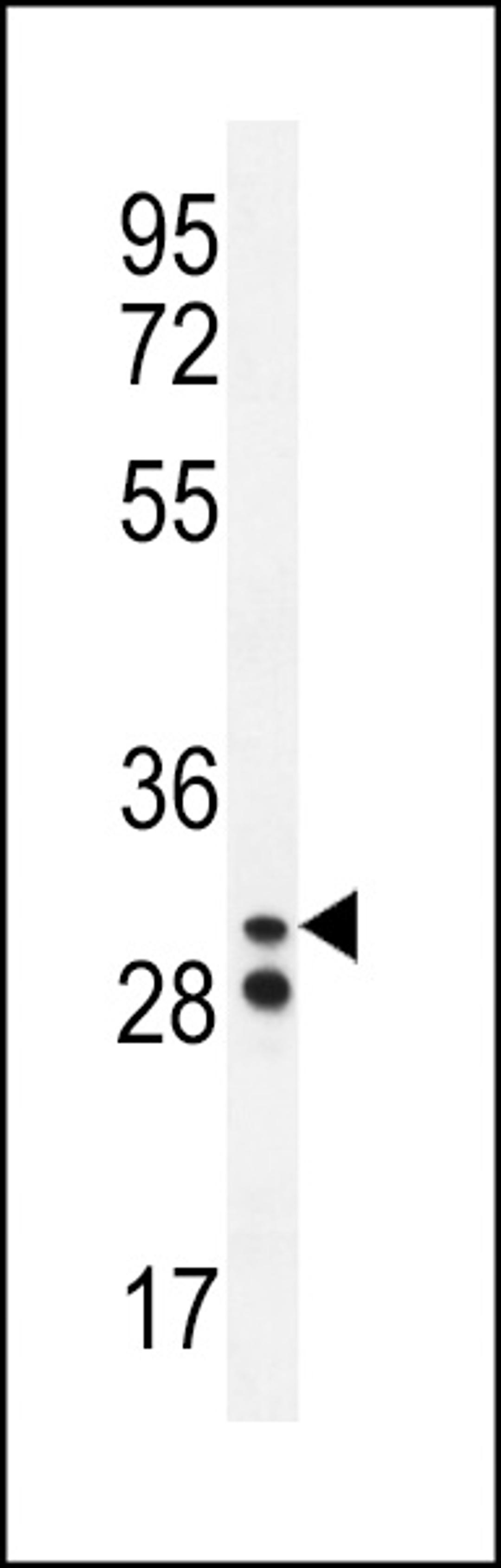 Western blot analysis in A2058 cell line lysates (35ug/lane).This demonstrates the Neutrophil elastase antibody detected the Neutrophil elastase protein (arrow).