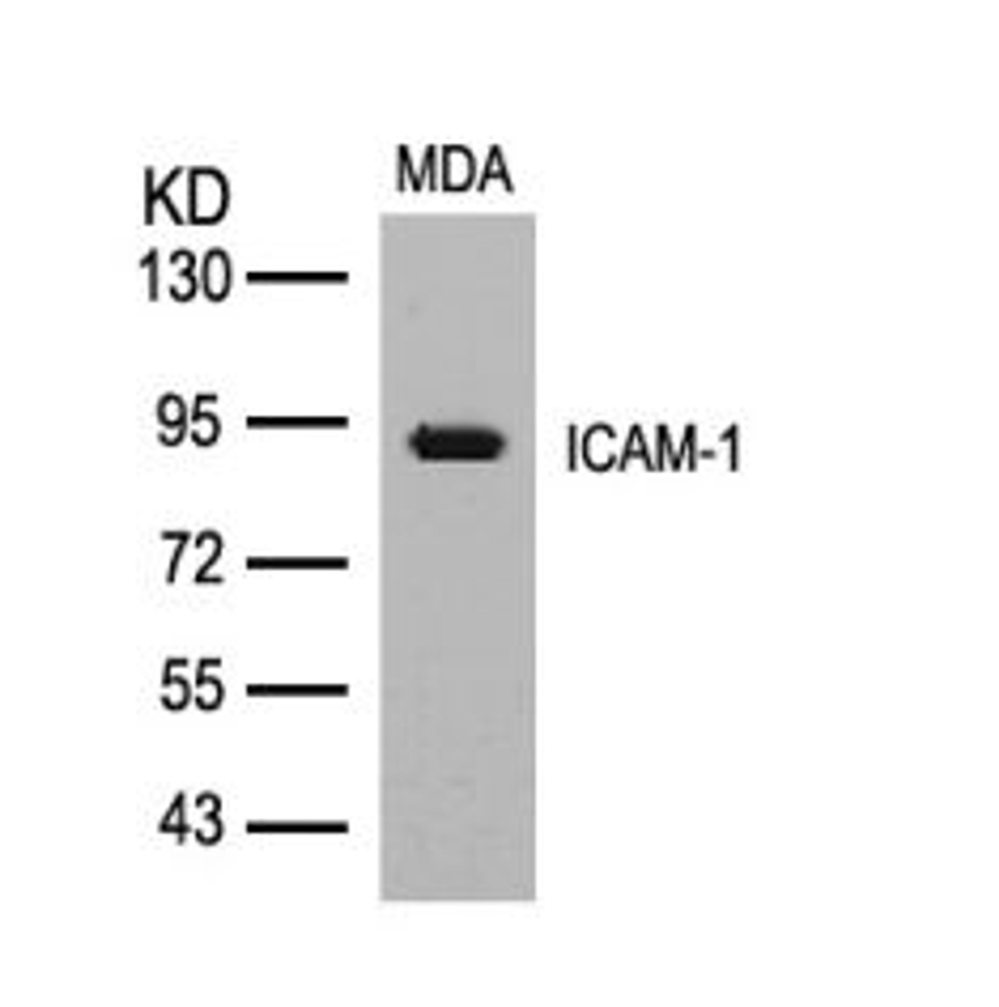 Western blot analysis of lysed extracts from MDA cells using ICAM-1 (Ab-512).