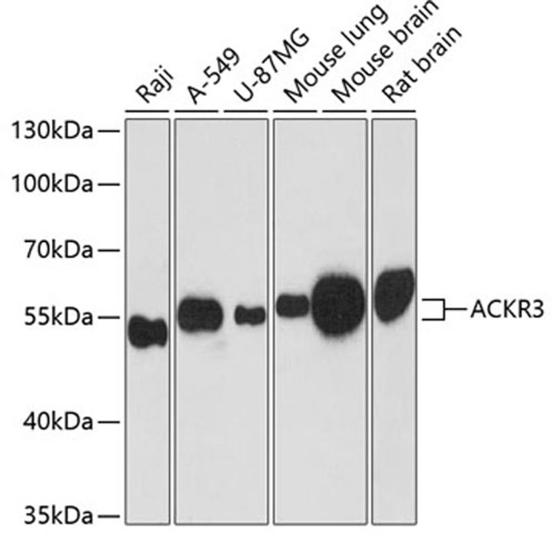 Western blot - ACKR3 antibody (A12712)