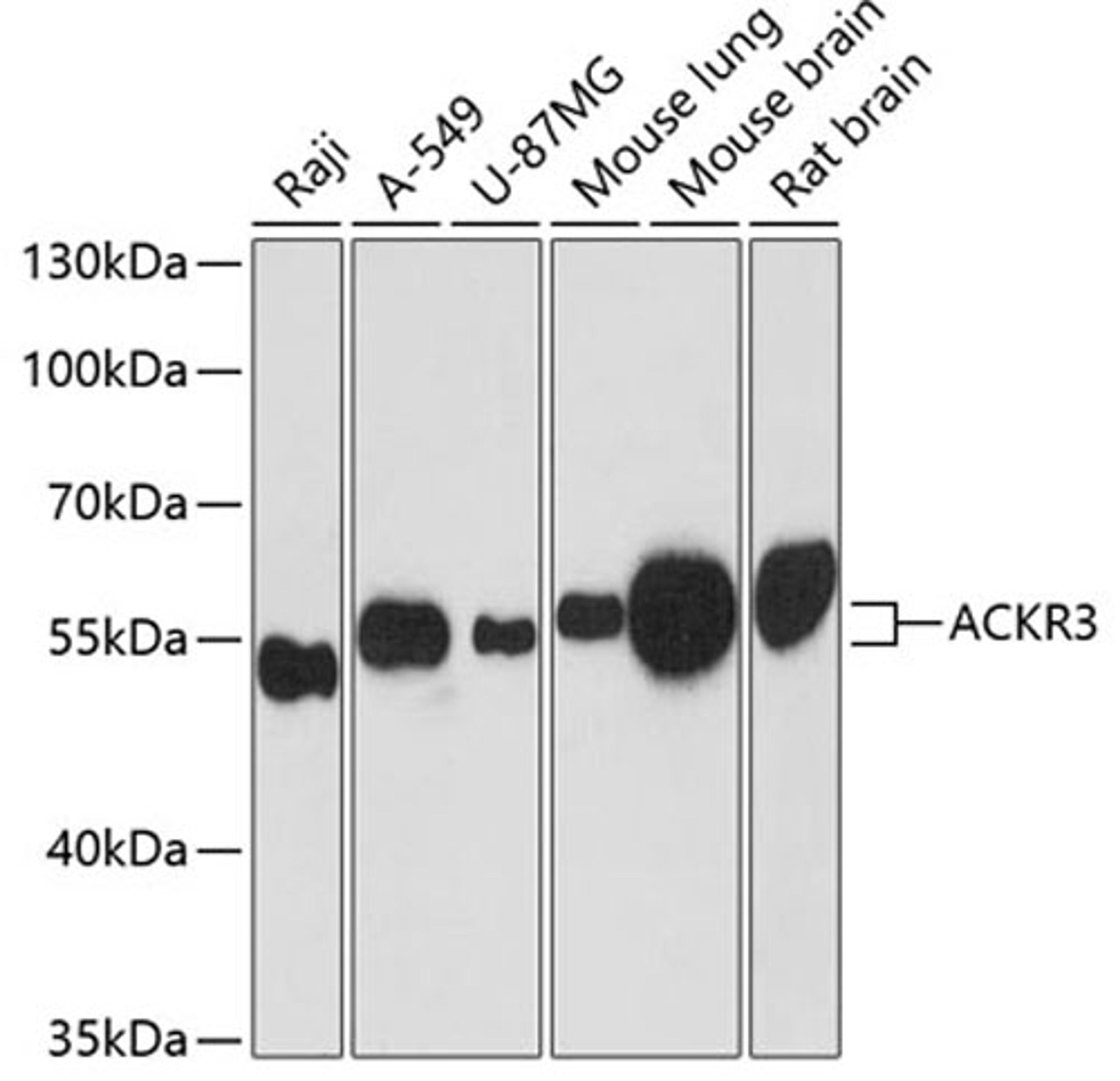 Western blot - ACKR3 antibody (A12712)