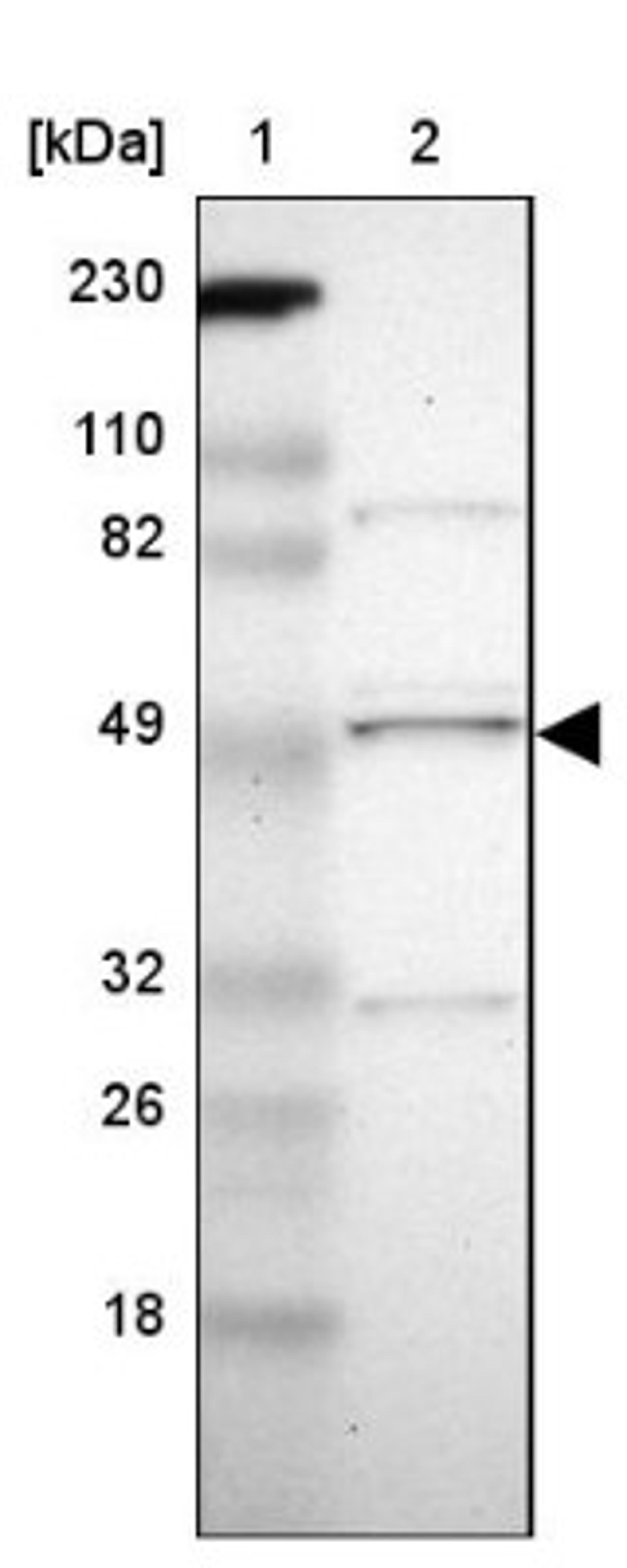 Western Blot: TTC8 Antibody [NBP1-88688] - Lane 1: Marker [kDa] 230, 110, 82, 49, 32, 26, 18<br/>Lane 2: Human cell line RT-4