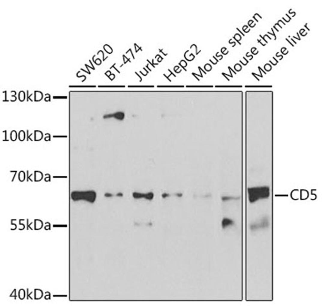 Western blot - CD5 antibody (A6882)