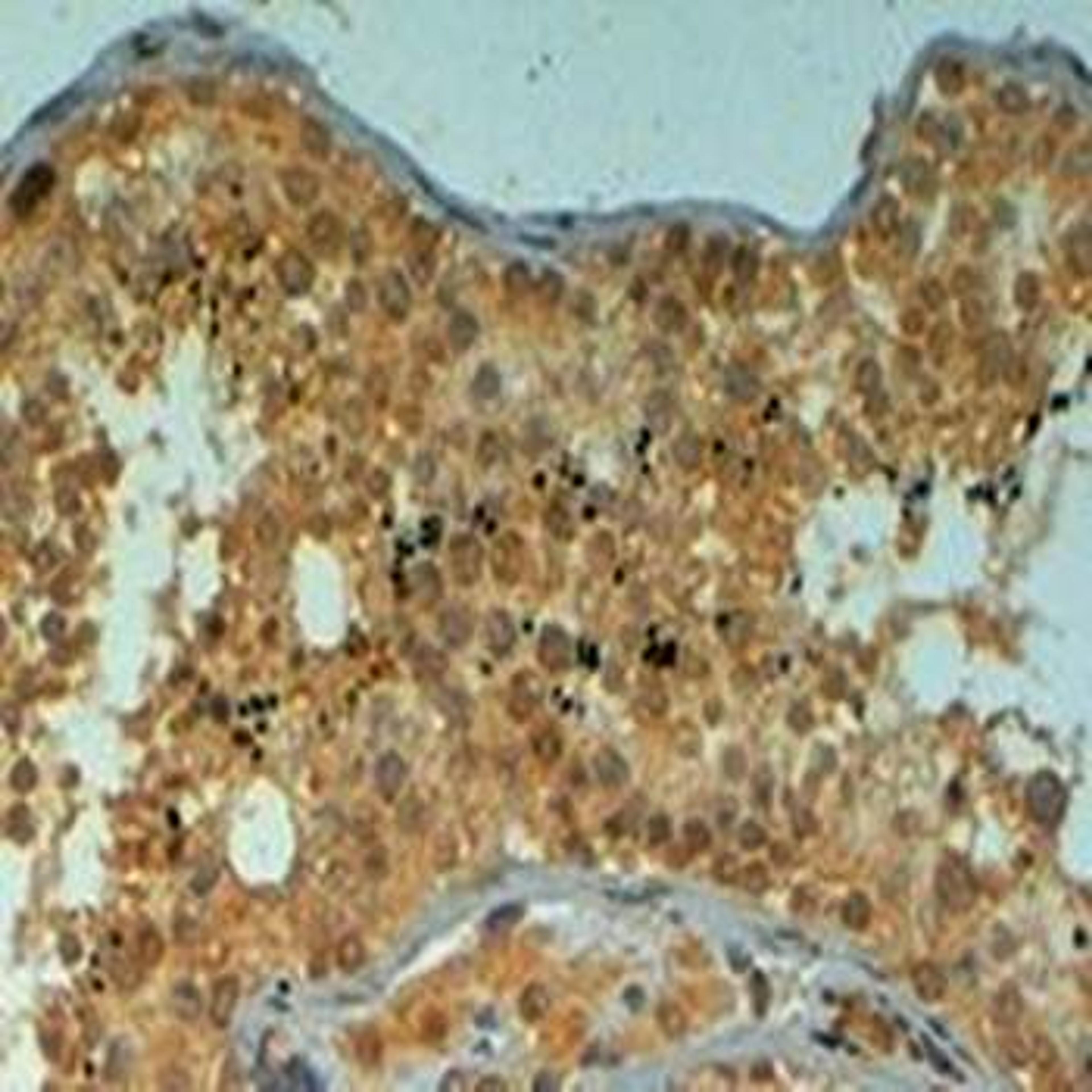 Immunohistochemical analysis of formalin-fixed and paraffin embedded Human Testis tissue (4ug/ml) using PIWI antibody