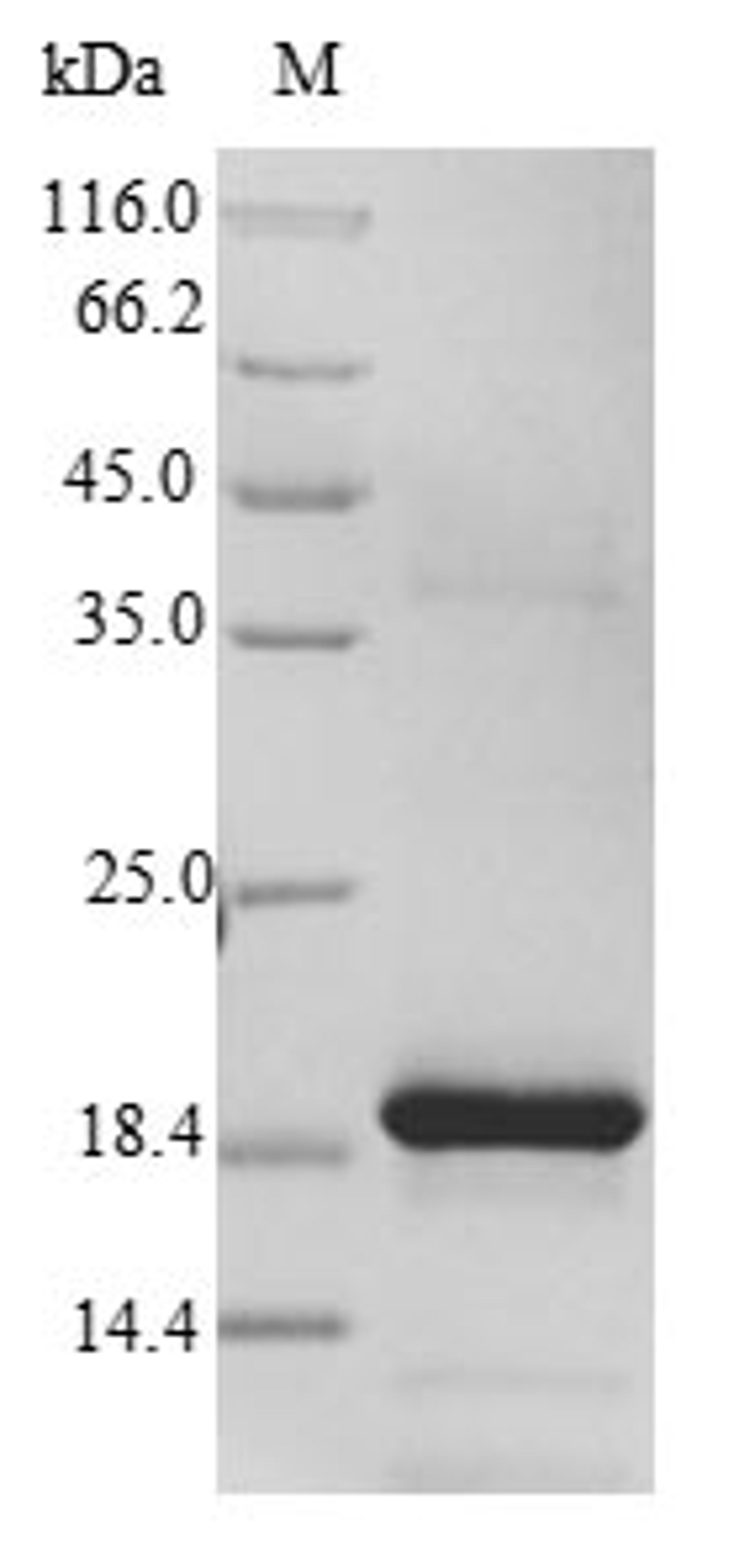 (Tris-Glycine gel) Discontinuous SDS-PAGE (reduced) with 5% enrichment gel and 15% separation gel.