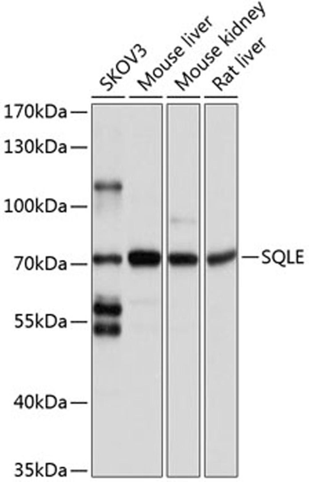 Western blot - SQLE antibody (A2428)