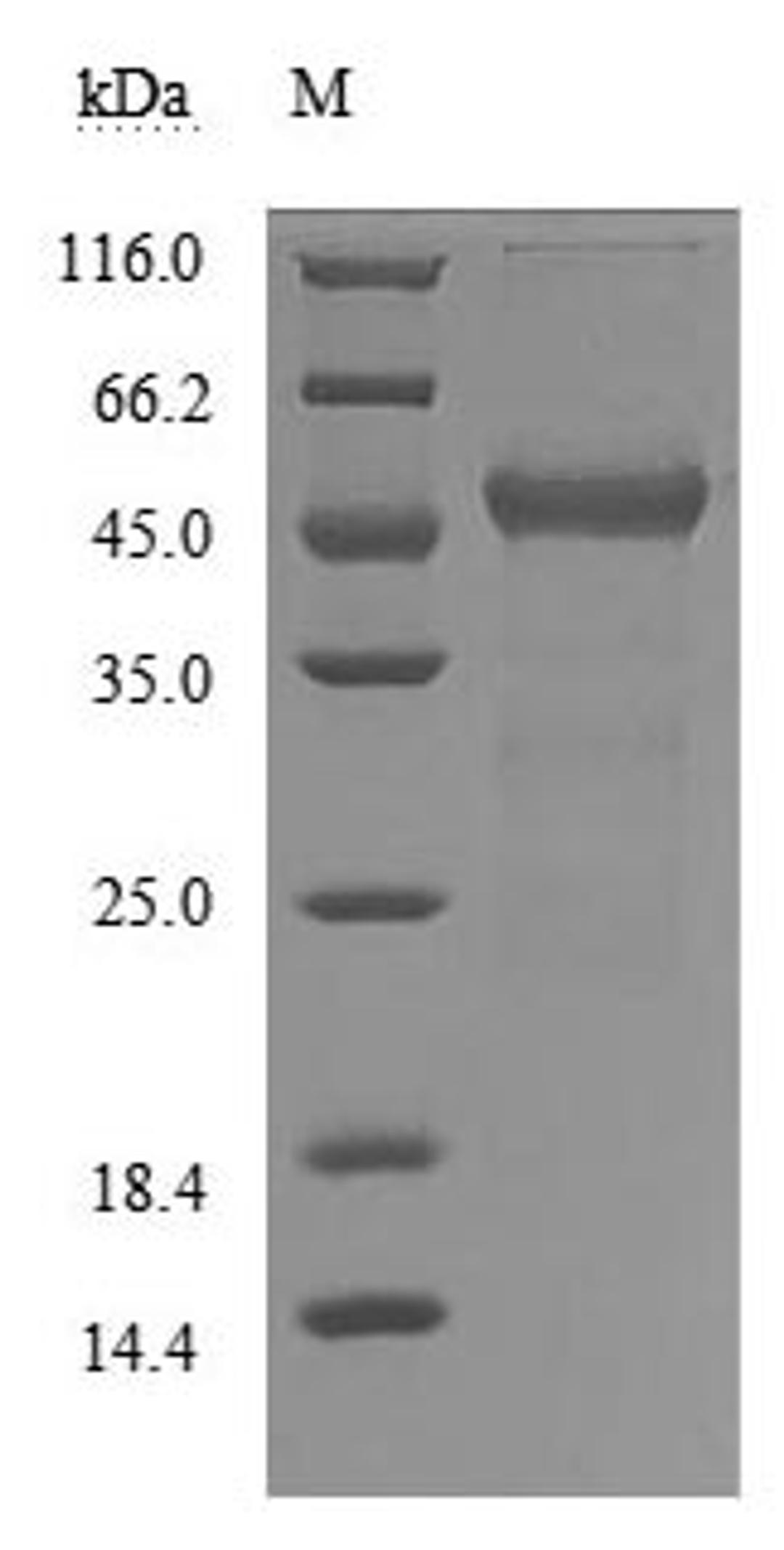 (Tris-Glycine gel) Discontinuous SDS-PAGE (reduced) with 5% enrichment gel and 15% separation gel.