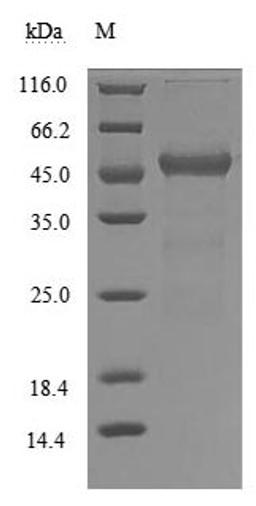 (Tris-Glycine gel) Discontinuous SDS-PAGE (reduced) with 5% enrichment gel and 15% separation gel.