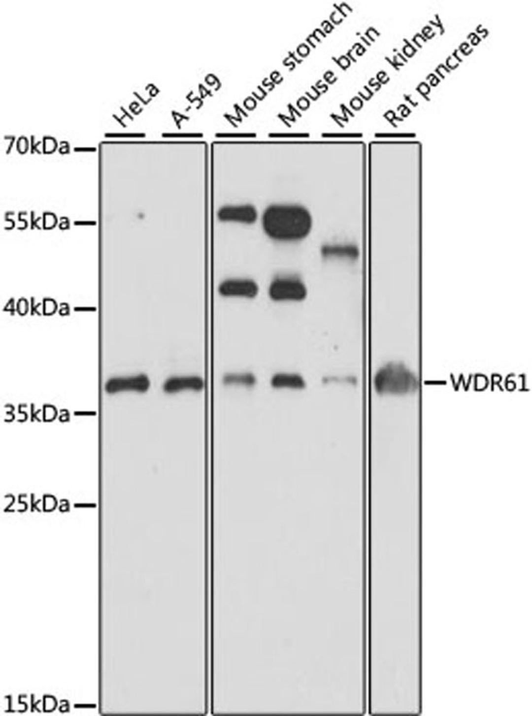 Western blot - WDR61 antibody (A15520)