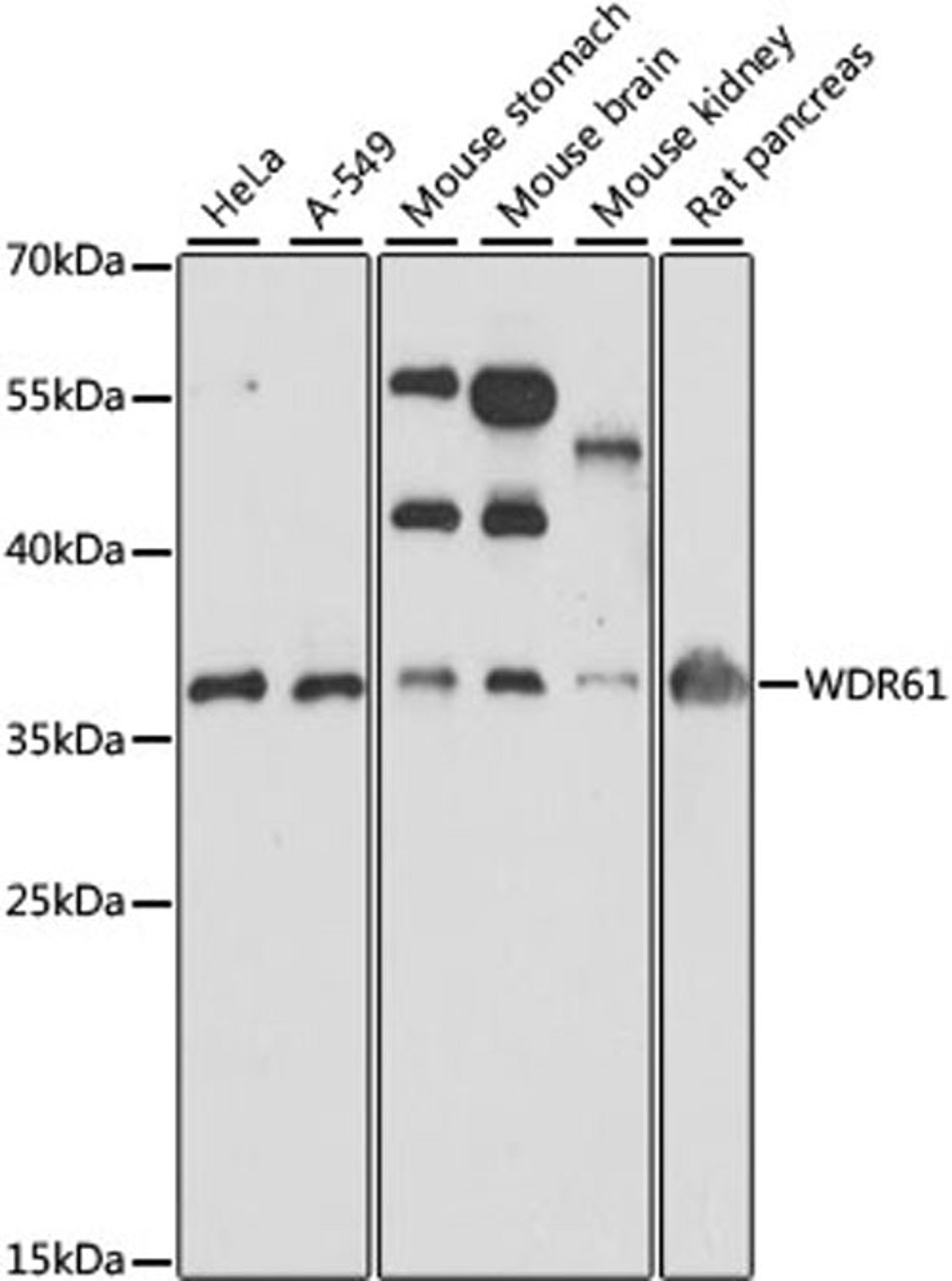 Western blot - WDR61 antibody (A15520)