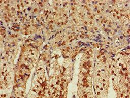 Immunohistochemistry of paraffin-embedded human adrenal gland tissue using CSB-PA004414LA01HU at dilution of 1:100