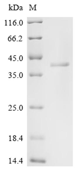 (Tris-Glycine gel) Discontinuous SDS-PAGE (reduced) with 5% enrichment gel and 15% separation gel.