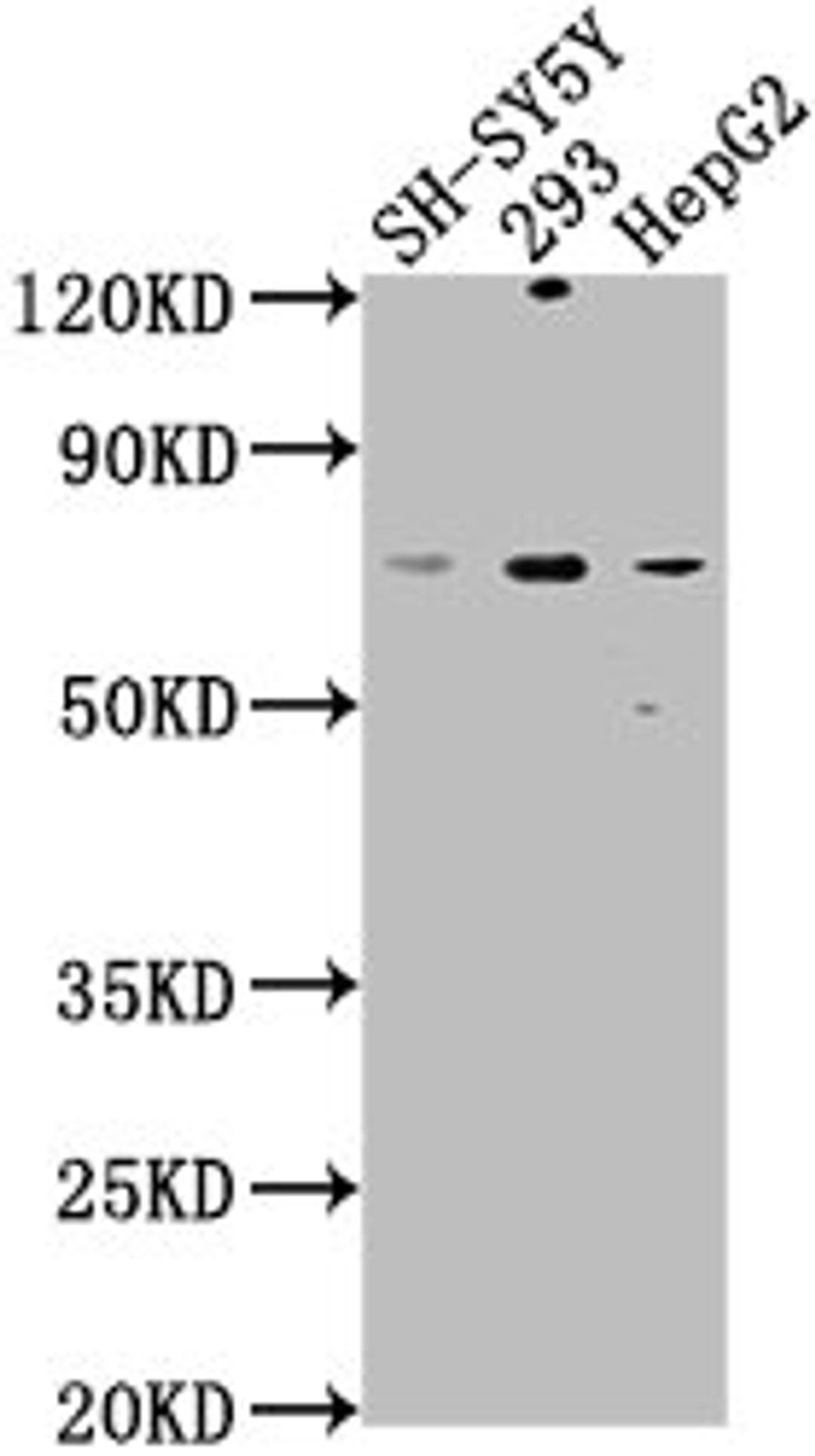Western Blot. Positive WB detected in: SH-SY5Y whole cell lysate, 293 whole cell lysate, HepG2 whole cell lysate. All lanes: HSPA12A antibody at 1:1000. Secondary. Goat polyclonal to rabbit IgG at 1/50000 dilution. Predicted band size: 75 kDa. Observed band size: 75 kDa.