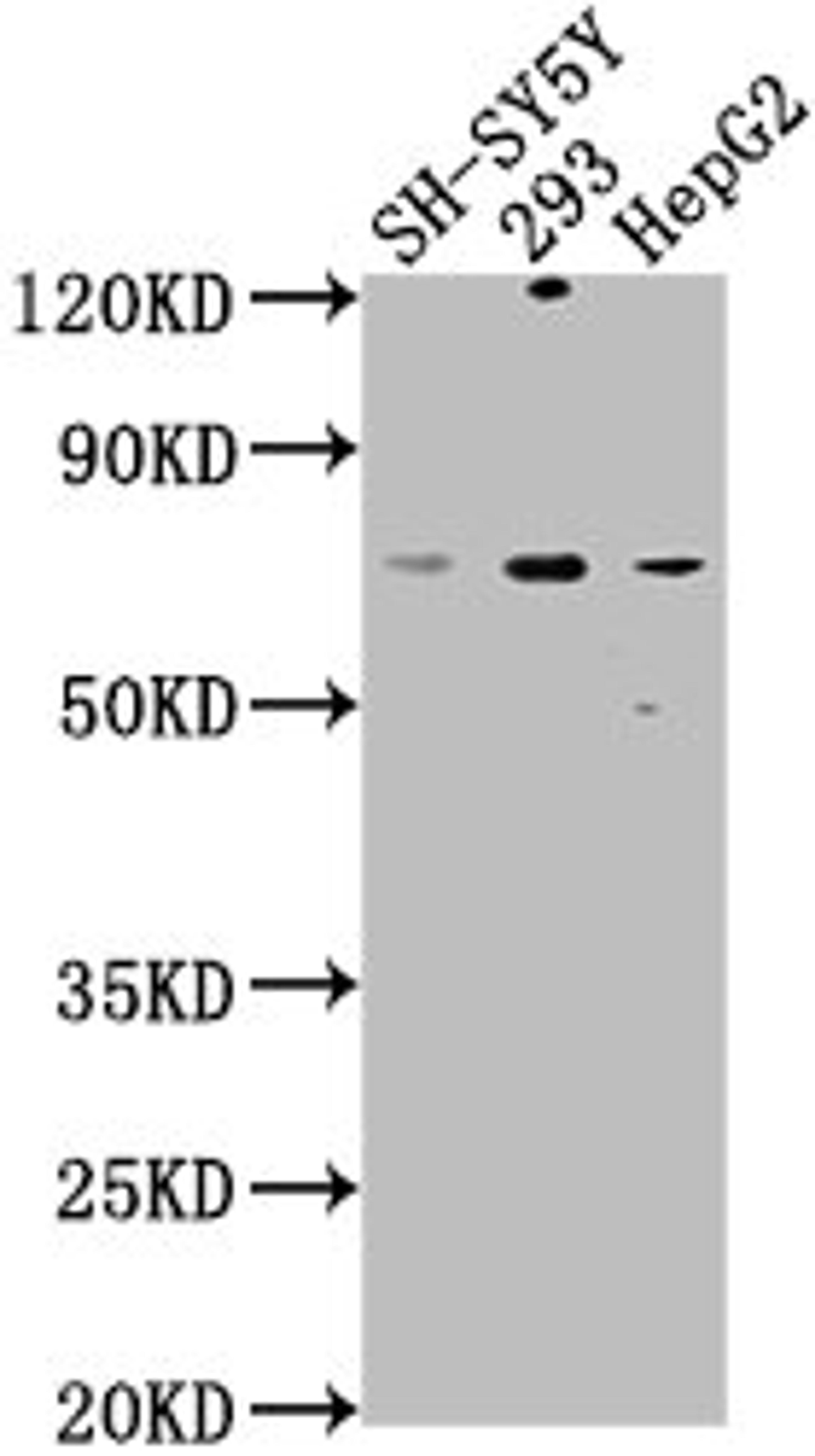 Western Blot. Positive WB detected in: SH-SY5Y whole cell lysate, 293 whole cell lysate, HepG2 whole cell lysate. All lanes: HSPA12A antibody at 1:1000. Secondary. Goat polyclonal to rabbit IgG at 1/50000 dilution. Predicted band size: 75 kDa. Observed band size: 75 kDa.