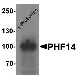 Western blot analysis of PHF14 in 293 cell lysate with PHF14 antibody at 1 μg/ml.