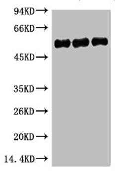 Western blot analysis of 1) Hela, 2) Mouse Brain, 3) Rat Brain, diluted at 1:5000.