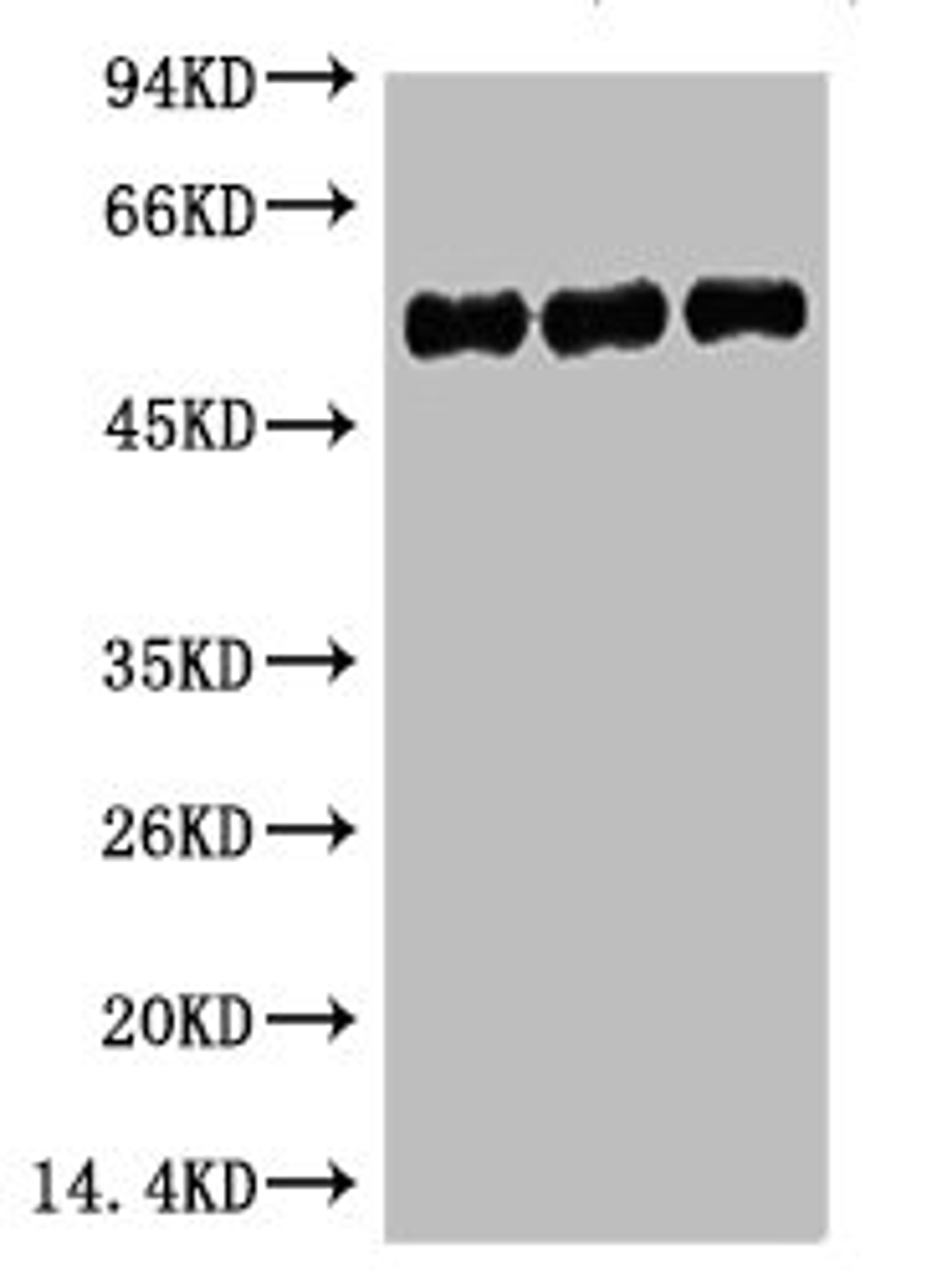 Western blot analysis of 1) Hela, 2) Mouse Brain, 3) Rat Brain, diluted at 1:5000.