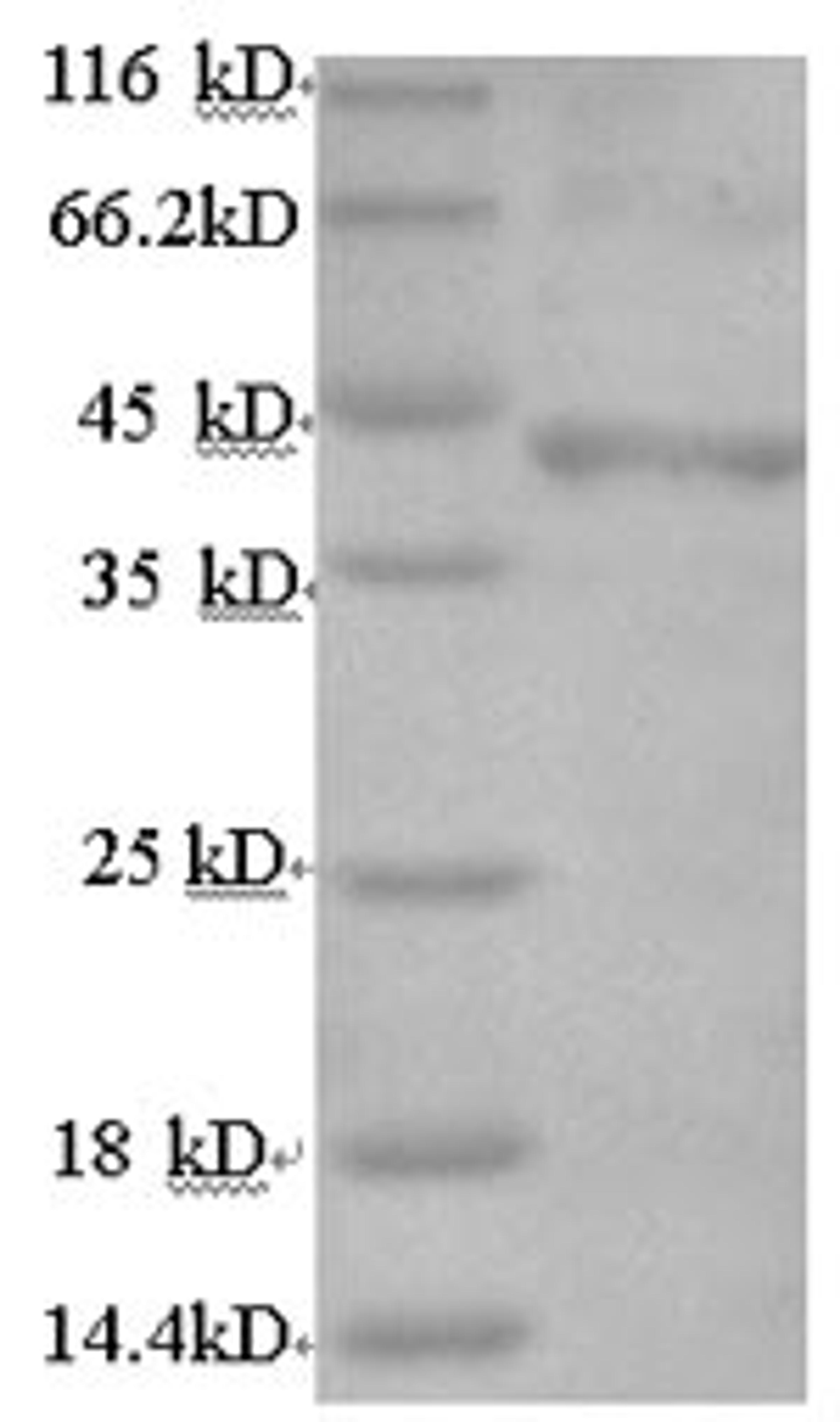 (Tris-Glycine gel) Discontinuous SDS-PAGE (reduced) with 5% enrichment gel and 15% separation gel.
