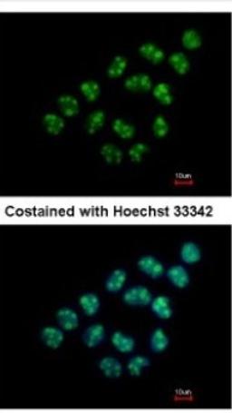 Immunocytochemistry/Immunofluorescence: NOL12 Antibody [NBP2-19560] - Analysis of paraformaldehyde-fixed A431, using antibody at 1:500 dilution.