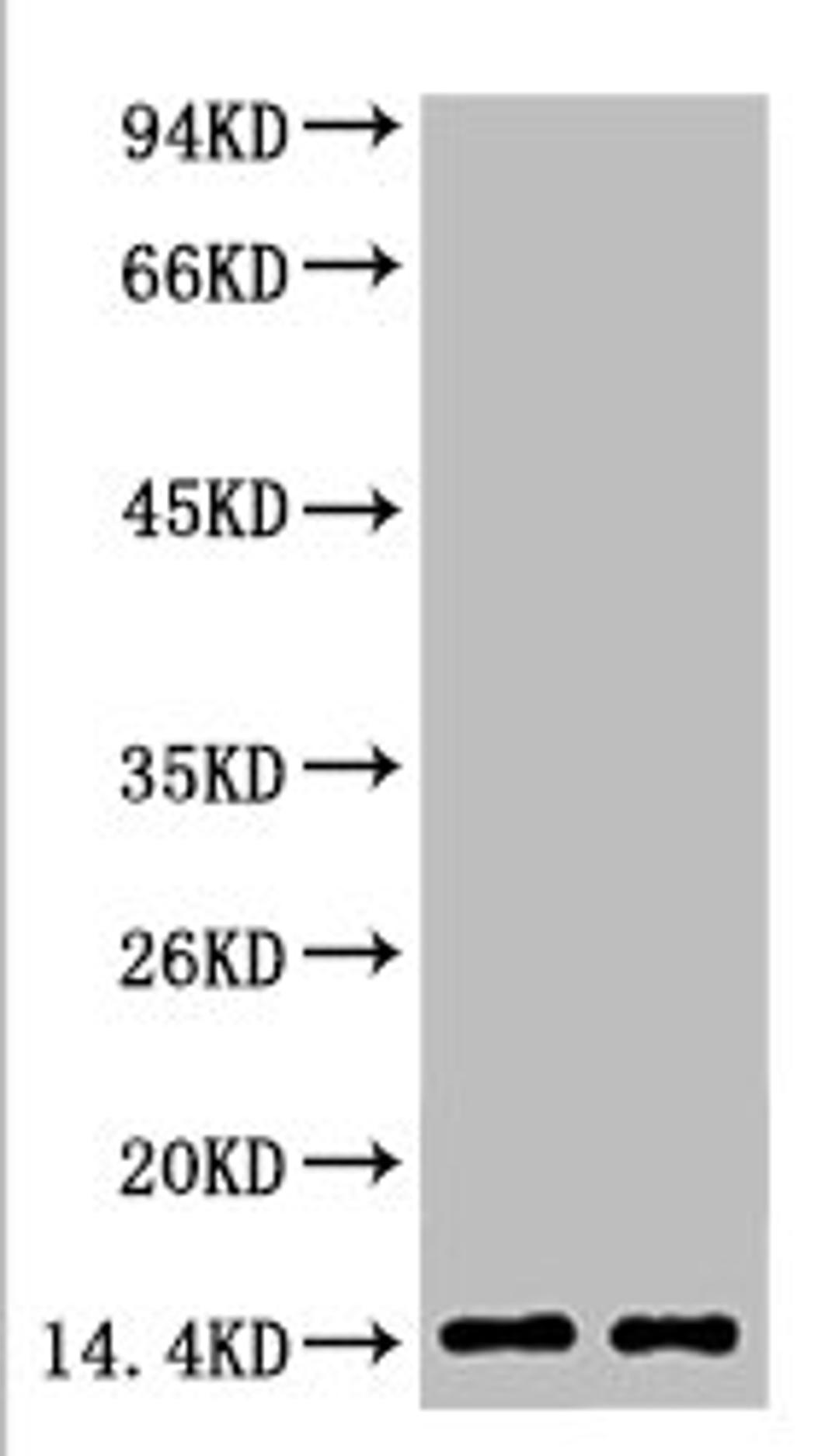 Western blot analysis of Hela, diluted at  1) 1:2000  2) 1:5000