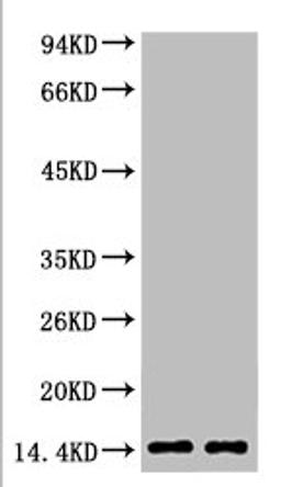 Western blot analysis of Hela, diluted at  1) 1:2000  2) 1:5000
