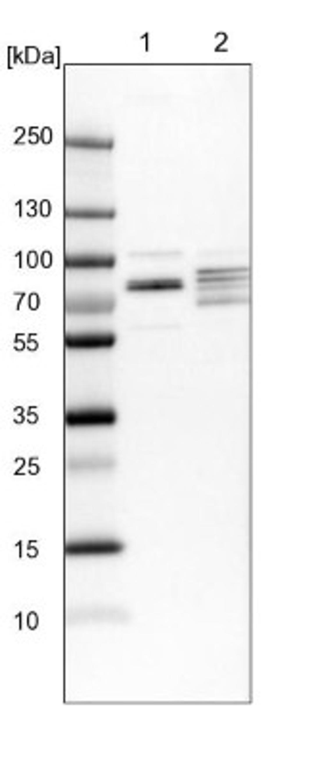 Western Blot: EXD2 Antibody [NBP1-88405] - Lane 1: NIH-3T3 cell lysate (Mouse embryonic fibroblast cells)<br/>Lane 2: NBT-II cell lysate (Rat Wistar bladder tumour cells)