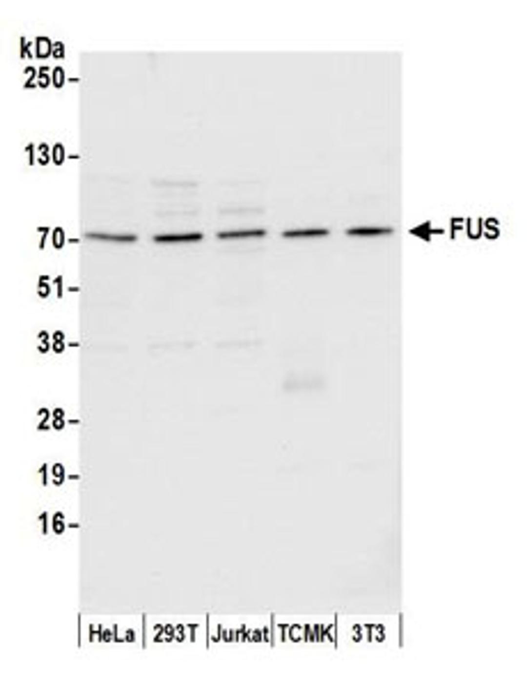 Detection of human and mouse FUS by western blot.