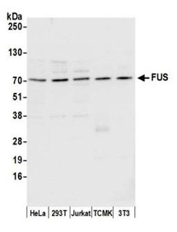 Detection of human and mouse FUS by western blot.