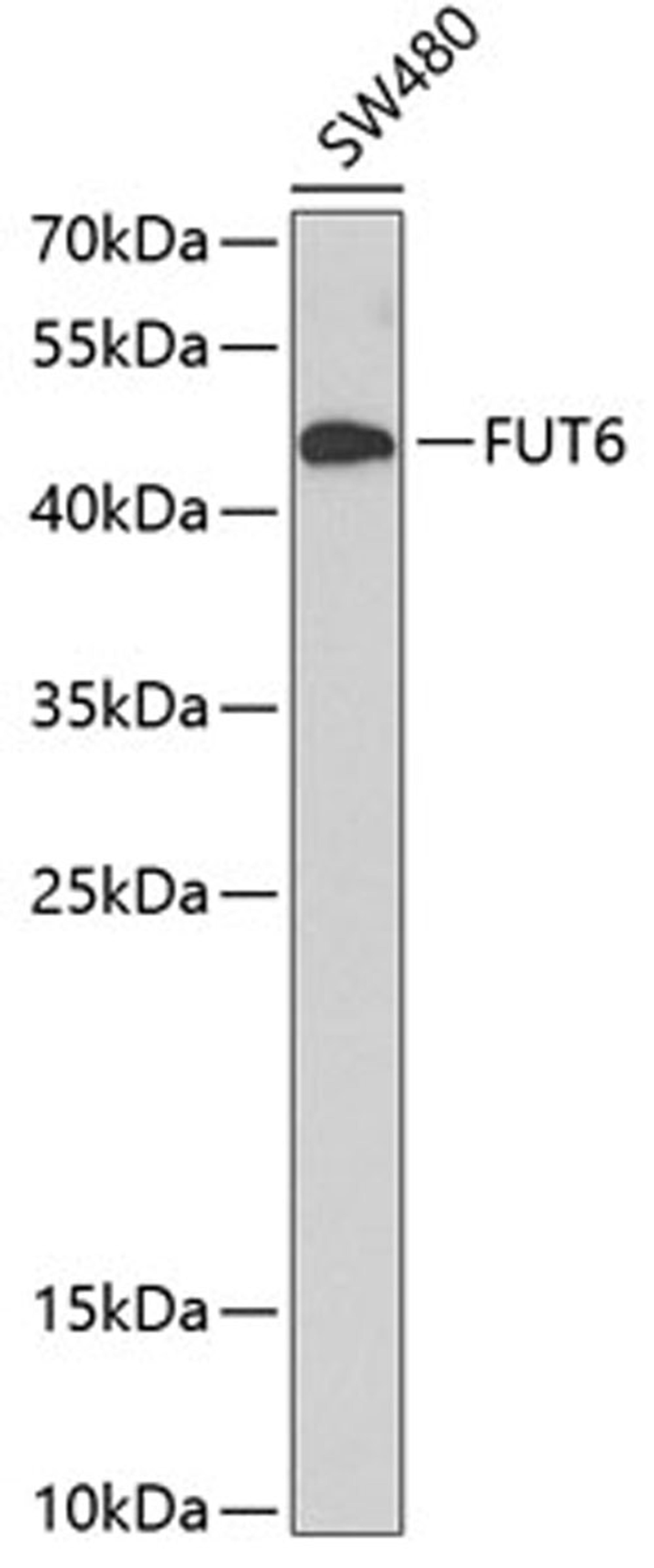 Western blot - FUT6 antibody (A3868)