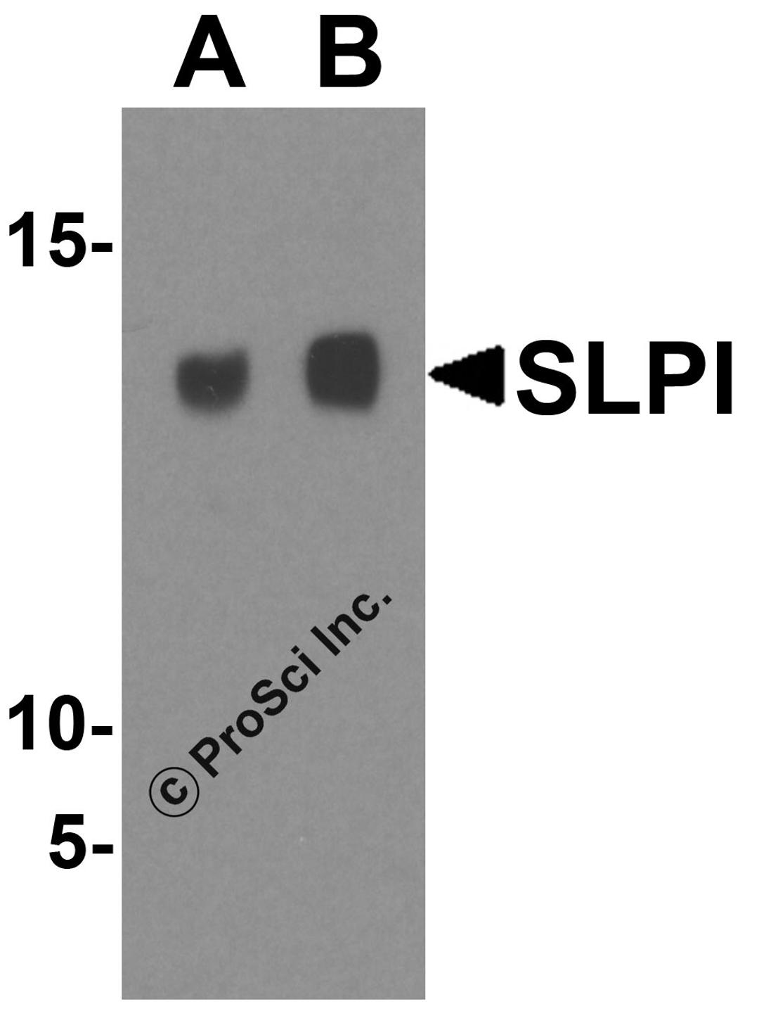 Western blot analysis of SLPI in A-20 cell lysate with SLPI antibody at (A) 1 and (B) 2 μg/mL.