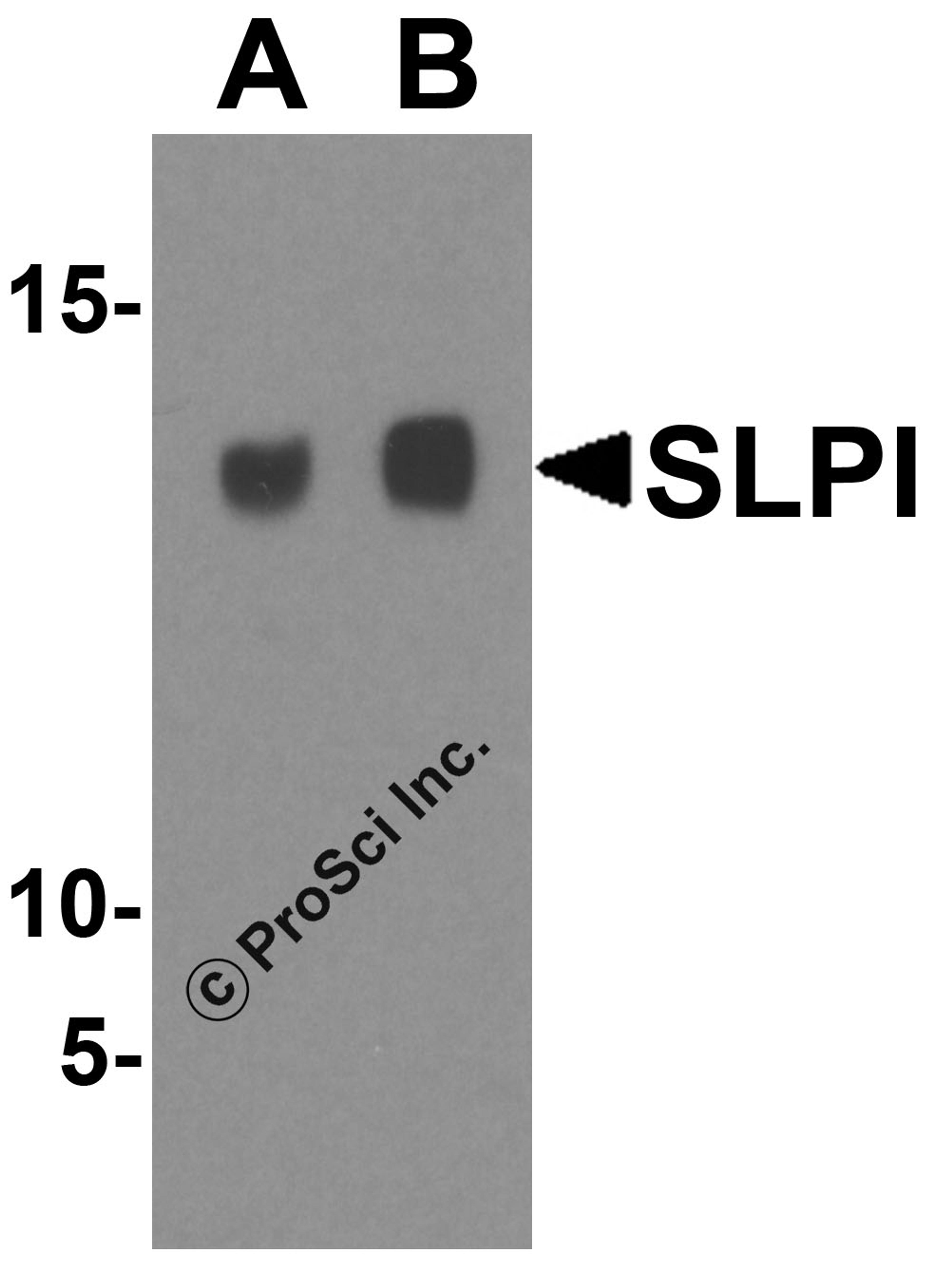 Western blot analysis of SLPI in A-20 cell lysate with SLPI antibody at (A) 1 and (B) 2 μg/mL.