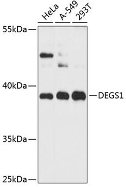 Western blot - DEGS1 antibody (A12648)