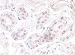 Detection of human GNL3 by immunohistochemistry.