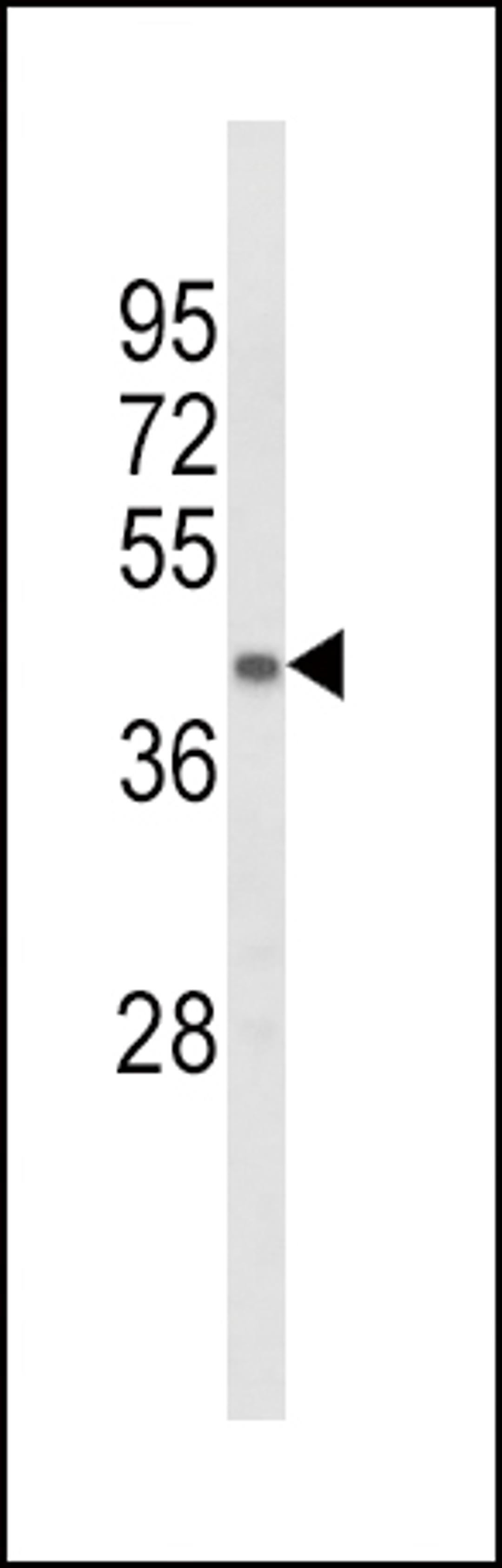 Western blot analysis of ACADL Antibody in mouse kidney tissue lysates (35ug/lane)