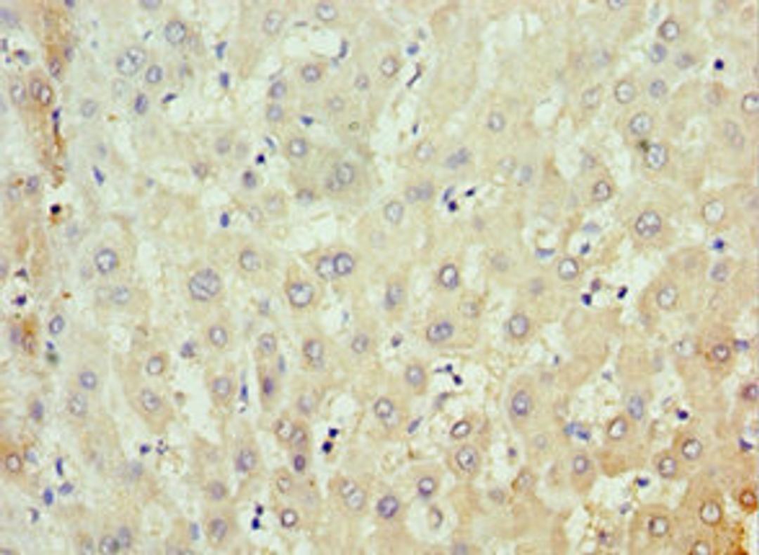 Immunohistochemistry of paraffin-embedded human liver tissue using CSB-PA882132ESR2HU at dilution of 1:100