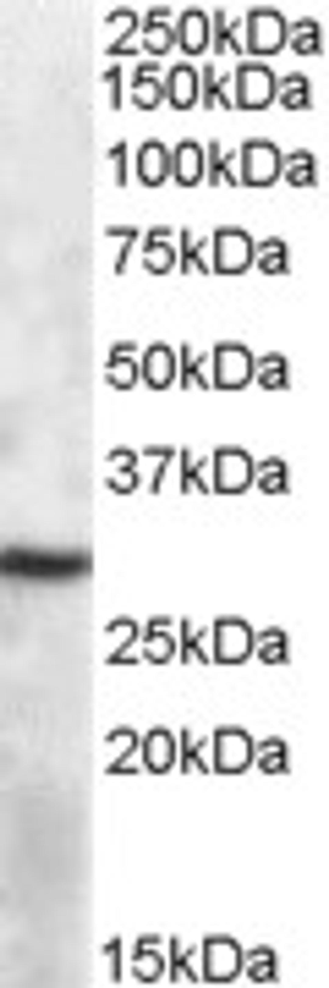 46-761 (1ug/ml) staining of Mouse Spleen lysate (35ug protein in RIPA buffer). Primary incubation was 1 hour. Detected by chemiluminescence.