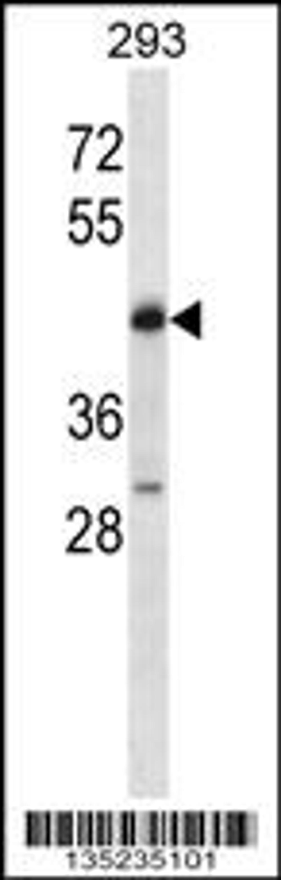 Western blot analysis in 293 cell line lysates (35ug/lane).