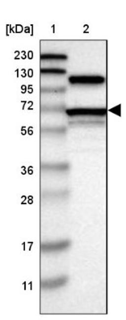 Western Blot: Arginyl tRNA synthetase Antibody [NBP1-88033] - Lane 1: Marker [kDa] 230, 130, 95, 72, 56, 36, 28, 17, 11<br/>Lane 2: Human cell line RT-4