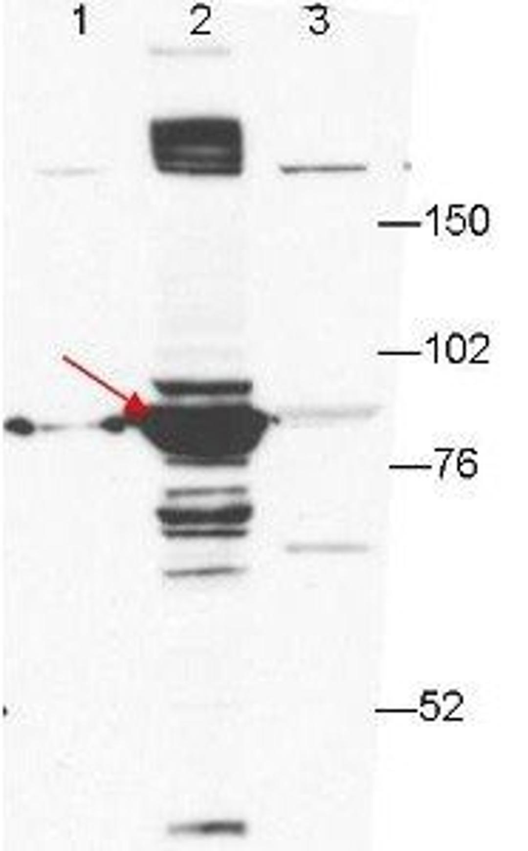 Western blot analysis of 293T cell extracts (lane 2, arrowhead). Lanes 1 and 3 contain GFP-transfected- and ESRP2-transfected 293T cell lysates using Esrp-1 antibody