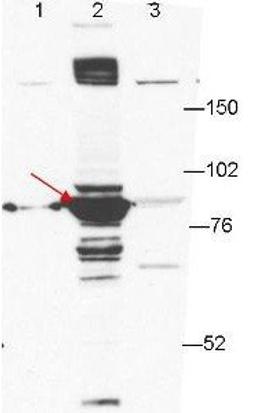 Western blot analysis of 293T cell extracts (lane 2, arrowhead). Lanes 1 and 3 contain GFP-transfected- and ESRP2-transfected 293T cell lysates using Esrp-1 antibody