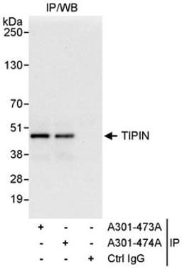 Detection of human TIPIN by western blot of immunoprecipitates.