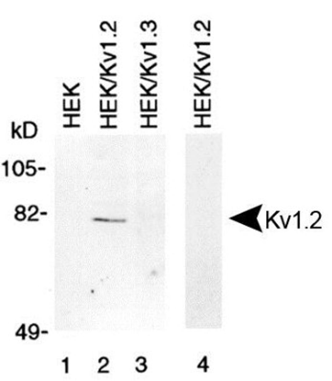 Western Blot: Kv1.2 Antibody [NBP1-42818] - Membrane preparations from HEK-293 cells untransfected (lane 1), transfected with Kv1.2 (lanes 2 and 4) and transfected with Kv1.3 (lane 3) were subjected to 10% SDS-PAGE and were Western blotted with the Kv1.2 Antibody (NBP1-42818). Lane 4 was probed with NBP1-42818 that had been preincubated with the peptide used to generate NBP1-42818.