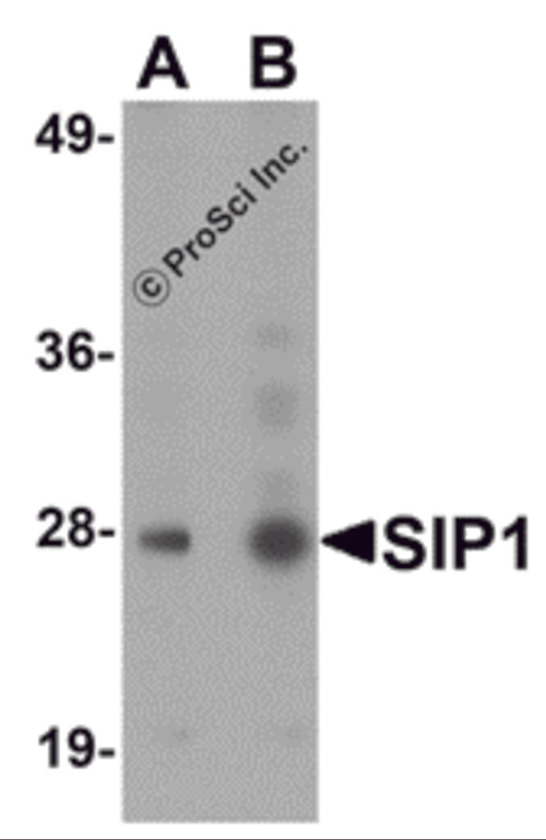 Western blot analysis of SIP1 in HeLa cell lysate with SIP1 antibody at (A) 0.5 and (B) 1&#956;g/mL.